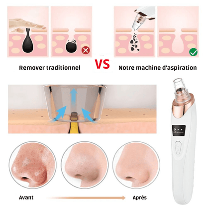 Aspirateur pour points noirs